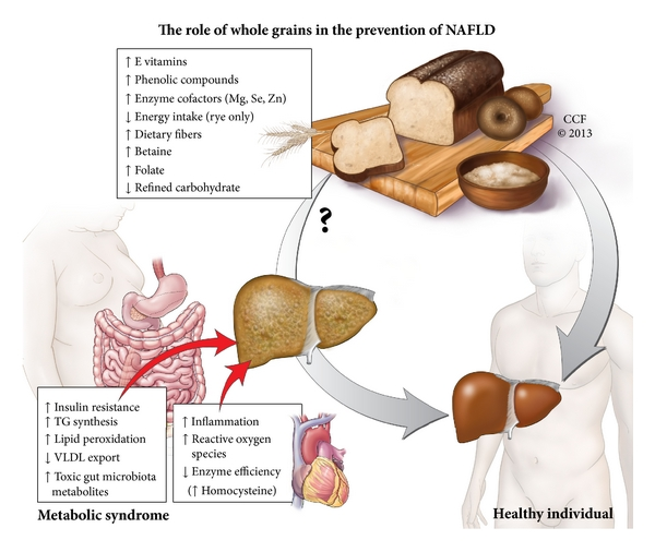 Whole-grains-may-have-an-impact-on-nonalcoholic-fatty-liver-disease-through-many.png