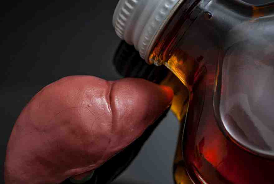 درمان کبدچرب الکلی با طب سنتی